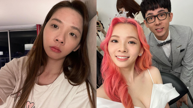 滴妹近日公開幕後照，驚見手肘大片紅疹。（圖／IG@crown_du）