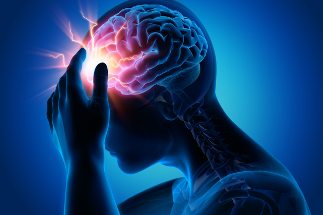 「偏頭痛」是「疾病」而非症狀，病人可能雙側或單側頭痛，可能博動性疼痛或抽痛，伴隨噁心、嘔吐、怕光、怕吵。疼痛指數高達7至9分，甚或超過滿分10分！偏頭痛長達數十年，最怕變慢性偏頭痛，醫師提醒：注意非典型的偏頭痛，想減少偏頭痛發作，最好做好3件事……（圖/ shutterstock）