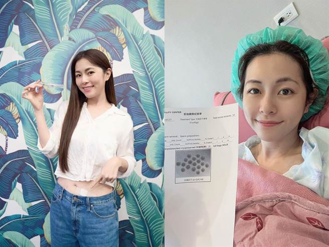 任容萱顺利冻卵，为生育提前作准备。（星星向容提供）