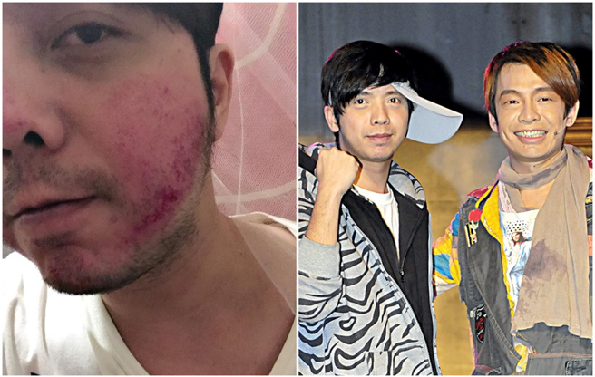 小炳不满路人诬蔑大炳，气得跟对方打架。（图／FB@余俊贤；中时资料照）