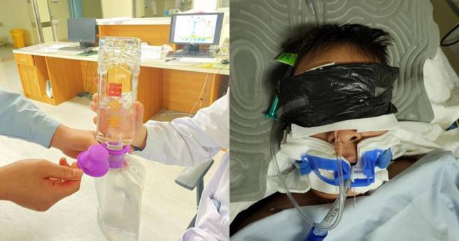 男誤喝假酒命危，醫生用「真白酒」解毒。（圖／翻攝自紅星新聞）