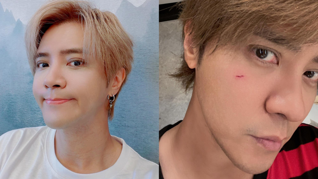 羅志祥昨日公開在舞台上摔傷的影片。（圖／FB@羅志祥 SHOW）