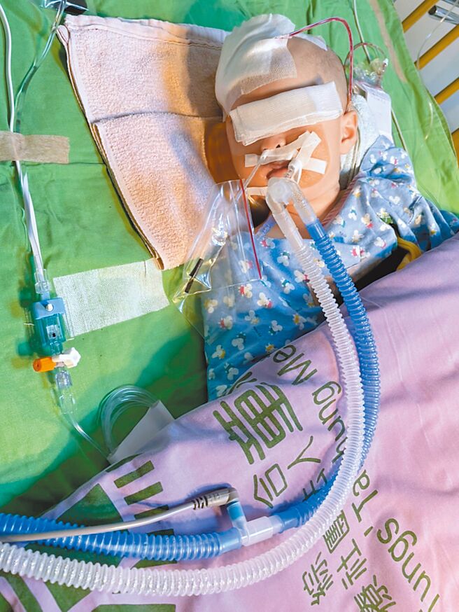 1歲女嬰小桃子11月8日去保母家後被診斷出顱內出血，開完刀後至今昏迷。（家長提供／張亦惠台中傳真）