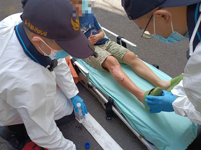 男童救火过程不慎烫伤。（翻摄照片／李京升苗栗传真）