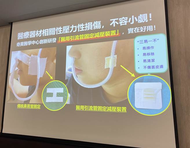 奇美醫學中心說明｢醫用引流管固定減壓裝置」的重要性。(曹婷婷攝)