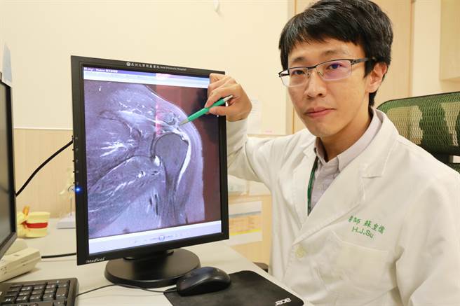 苏皇儒指出，旋转肌撕裂的症状包含疼痛、肩膀无法负重，严重者更会影响日常生活，透过关节镜微创手术可以更深入、全面改善。（亚大附医提供／潘虹恩台中传真）