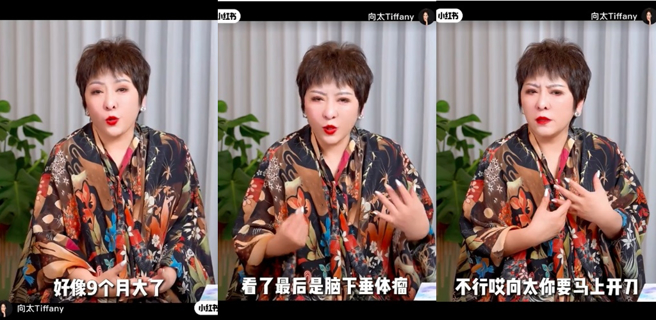 向太陈岚诉说过往曾患脑下垂体瘤。（图／向太Tiffany小红书截图）