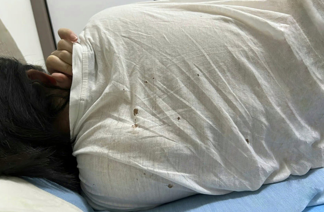 男網友分享老婆熟睡的照片，睡衣背面有許多大小不一的破洞。（圖／翻攝自爆廢公社公開版）