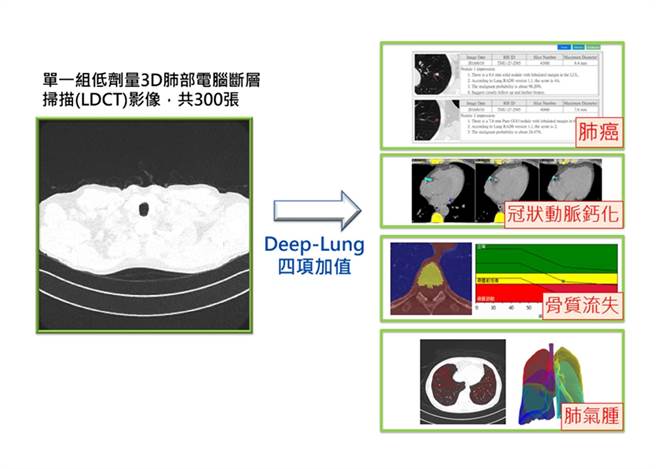 臺北医学大学副校长陈震宇研究团队研发「Deep-Lung 人工智慧多模影像精准健康平臺」，一张低剂量电脑断层扫描即可预测4种疾病，准确率可达9成，是全球首创的服务。（北医大提供）