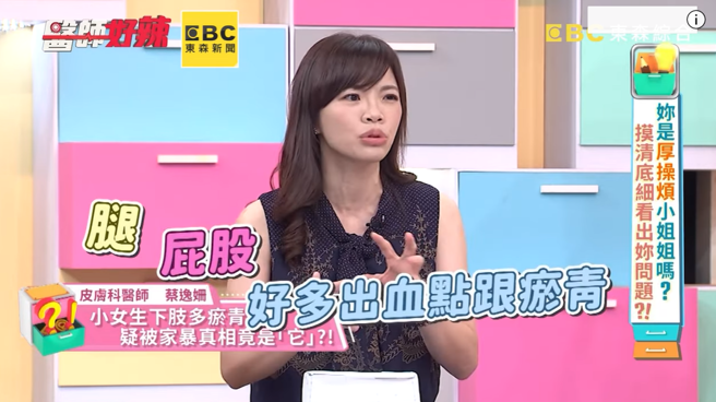 女童因发烧、关节痛住院，医师检查时发现女童下半身有一点一点淤青，呈现数以千计的出血点，切片检查才得知是免疫系统出问题造成的血管炎疾病。（翻摄自《医师好辣》YouTube）