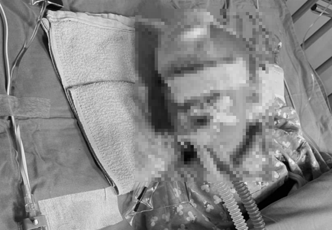 台中市清水1岁女童「小桃子」上月在蔡姓保母家突然昏迷，经院方积极抢救后，2日上午拔管。（家长提供）