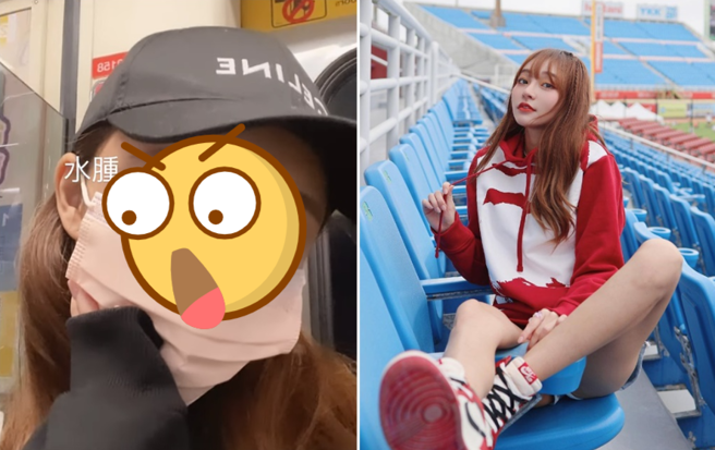 林襄公开水肿的模样。（图／IG@林襄）