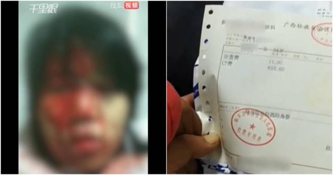 大陆一名女子疑似遭到公公家暴。（图／撷取自微博）