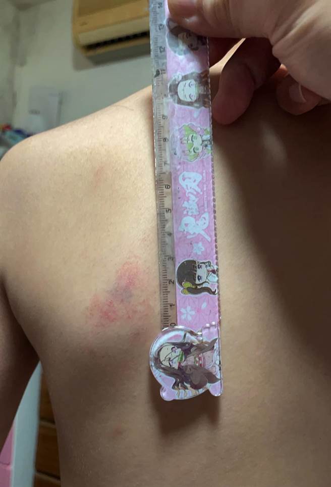 台中一名国小教师遭质疑不当体罚学生，家长获知后带孩子验伤提告。（图／翻摄脸书「我爱大甲2」）