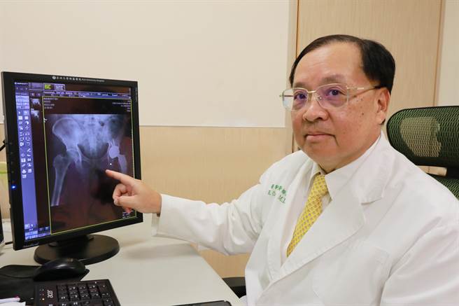 亚洲大学附属医院副院长、骨科主治医师黄揆洲指出，常因服用过量类固醇及长期酗酒，造成髋关节血液循环受到影响，患者恐演变成「股骨头缺血性坏死」。（亚大附医提供／潘虹恩台中传真）