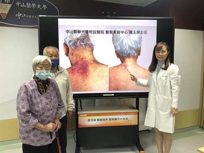 台中83岁婆婆患有异位性皮肤炎，婆婆常在睡梦中红痒难耐抓到流血，令子女相当不舍，经口服标靶药物治疗，有效止痒更成功改善皮肤状况。（中山附医提供／潘虹恩台中传真）