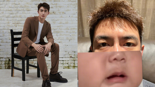 林更新近日发烧却买不到退热贴只能尝试网路偏方。（图／微博@林更新）