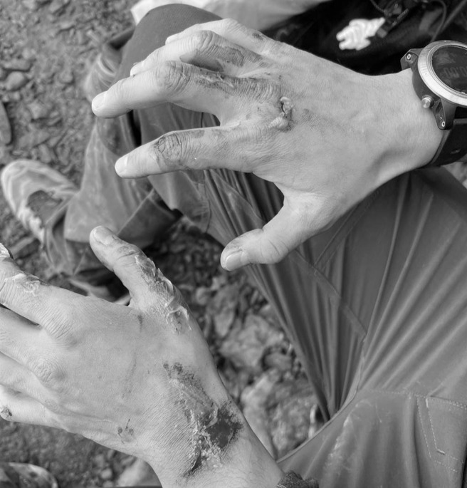 花莲中午发生规模6.2地震，玉山主峰出现落石砸伤山友意外，有5人轻伤。（南投县消防局提供／廖志晃南投传真）