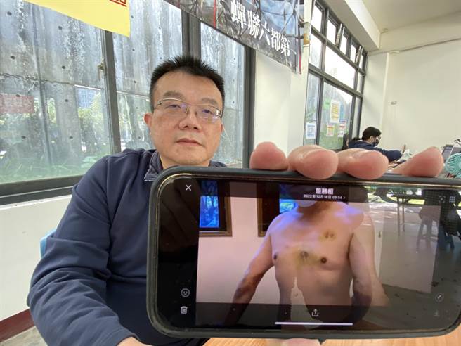 开业医师施胜桓秀出李先生猝死救回后传给他的照片，胸部和手部都还流有PCR压胸和电击的痕迹。（冯惠宜摄）