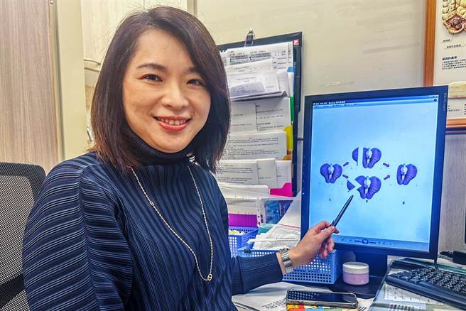 中医大新竹附设医院外科部长沈名吟指女性阴唇肥大，后天性可能跟长期持续性的刺激或磨擦有关。（罗浚滨摄）