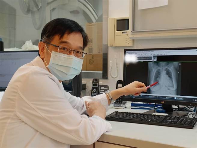 褚佩寰副院长检视病人X光。（为恭医院提供／李京升苗栗传真）