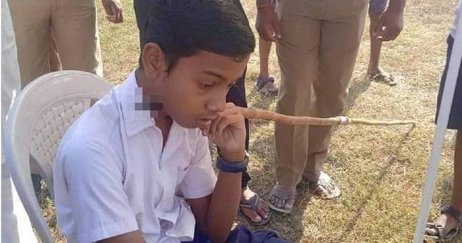 14岁少年梅赫幸运从致命的标枪意外中存活。（图／翻摄自推特）