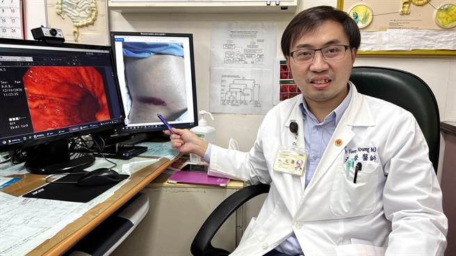 屏东基督教医院胃肠肝胆科主治医师蔡元荣发现罕见成人自发性腹股沟瘀青不治病例，是全球文献首例。（屏基提供／谢佳潾屏东传真）