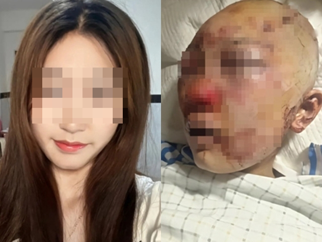 浙江一名平时拍抖音的网美女子10月底在公厕遭陌生男子袭击，男子将她压在地上拿砖头狂砸头部，她试图逃出还被拖回厕所，在遭「挖眼睛、拔舌头」。（翻摄照片）