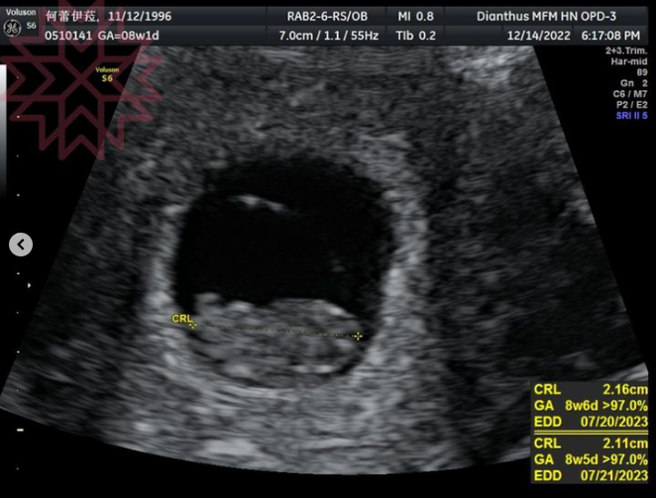 蕾菈晒超音波照。（图／IG@la.112814）