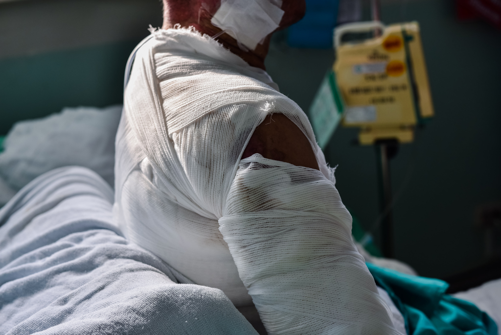 法国敷料公司Urgo的研究人员过去18个月不断努力，朝向达成伤口治疗的「圣杯」前进，让严重烧烫伤患者不再需要承受目前痛苦的一次次植皮。示意图/shutterstock(photo:ChinaTimes)