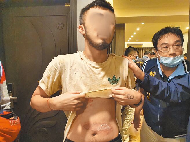 落入诈骗集团陷阱的受害者，不仅被限制自由，也动辄遭到虐打，桃园中坜青埔的受害者被救出时，身上出现严重伤势。（警方提供／黄敬文新北传真）