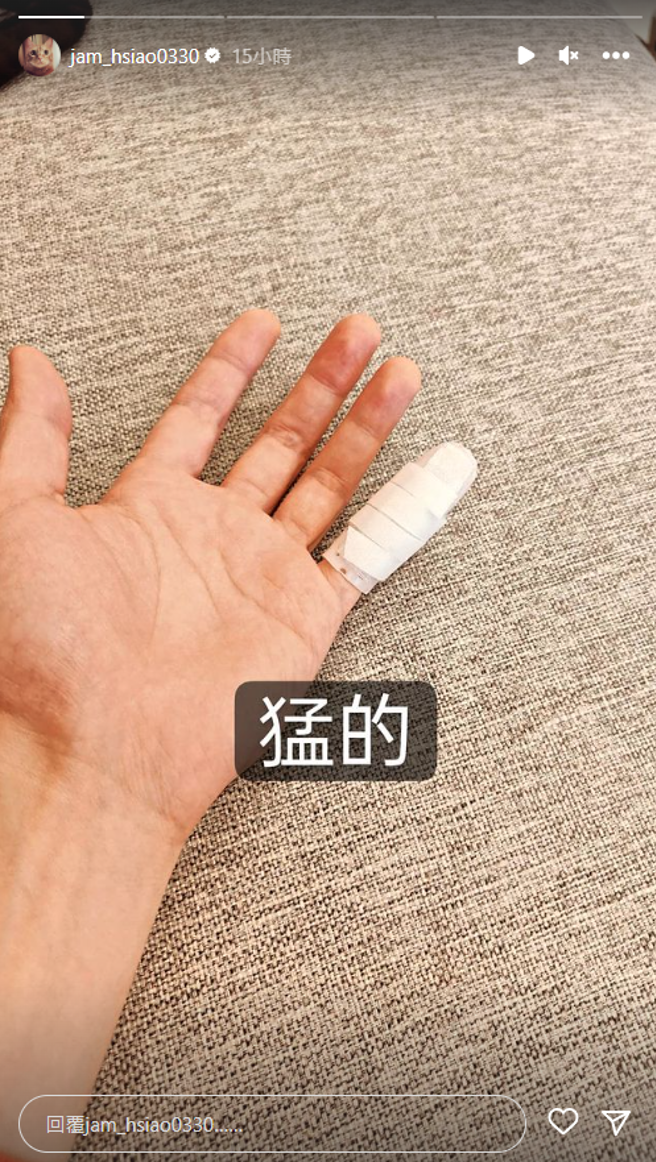 萧敬腾惊传打球造成骨裂紧急送医。（图／IG@萧敬腾 ）