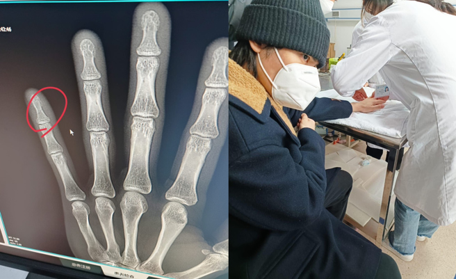 萧敬腾痛到前往医院照X光。（图／萧敬腾经纪人提供）