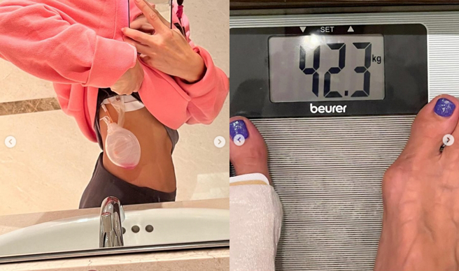 李玟暴瘦到42公斤，身上挂引流袋画面，让粉丝担忧她健康是否出状况。（图／摘自Coco李玟IG）