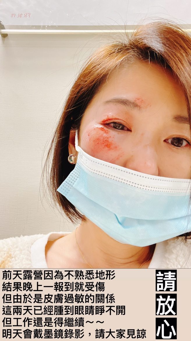 六月在脸书公开伤照与受伤原因。（图／FB@六月）