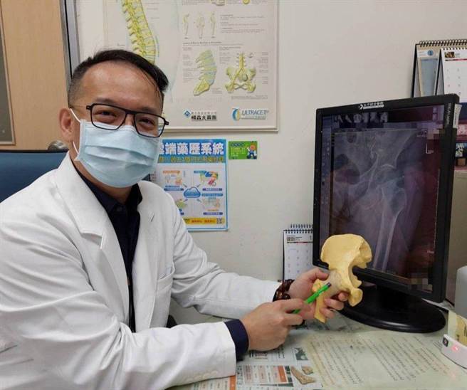 羅浩儒醫師建議，婦女停經後要注意骨質疏鬆的問題，才能避免骨折的發生。（大千醫院提供／李京昇苗栗傳真）