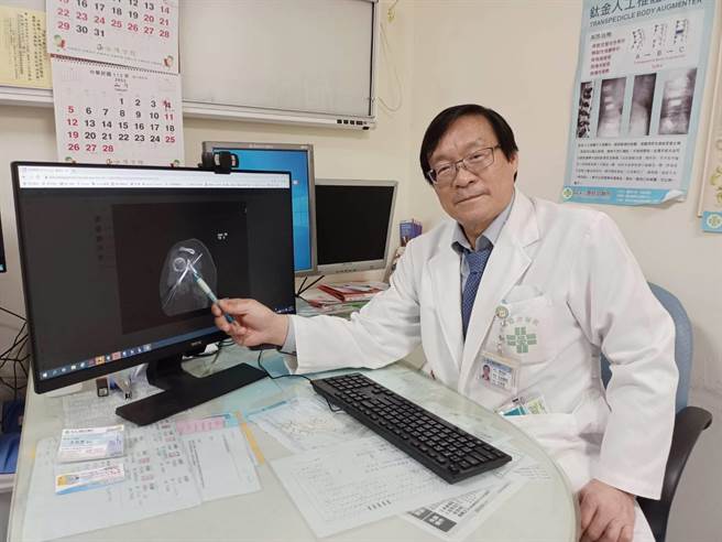 童综合医院骨科王叔昂医师笔指处，即为右肩前盂唇微创手术復位后位置。（童综合医院提供）