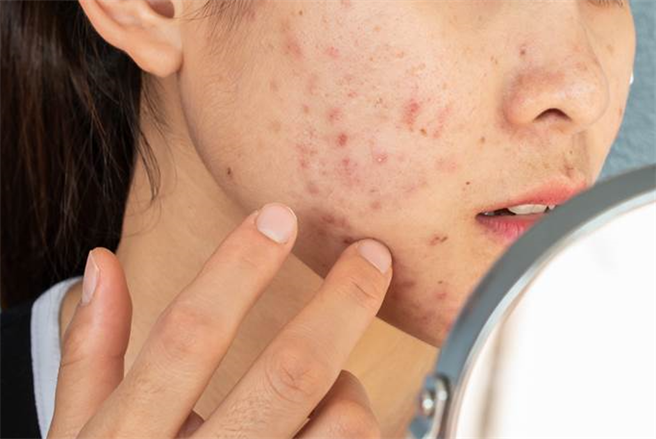 过年期间大鱼大肉不忌口，加上熬夜搓麻将、追剧，容易导致皮肤加速老化。(示意图／ Shutterstock)