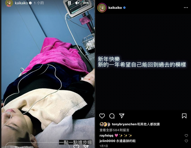 柯震东拍戏破相，全面停工接受治疗。（图／摘自柯震东IG）