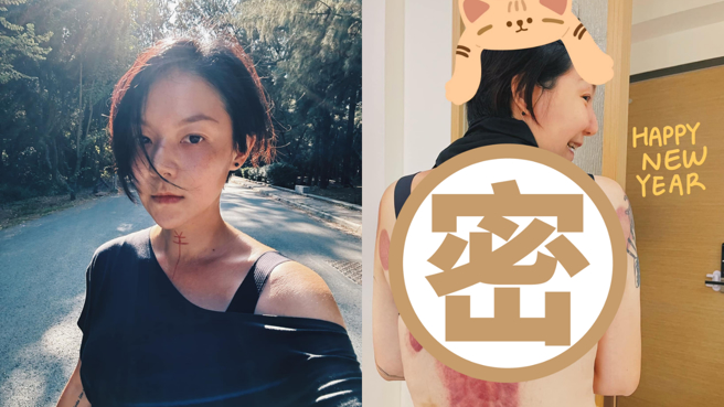 欧阳靖背部惊见大片刮痧拔罐后的痕迹。(图/欧阳靖 FB)