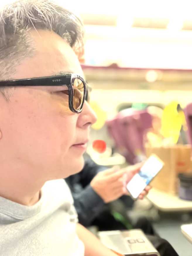 詹惟中的右眼布满恐怖血丝，医师安慰是好兆头。(图/詹惟中 FB)