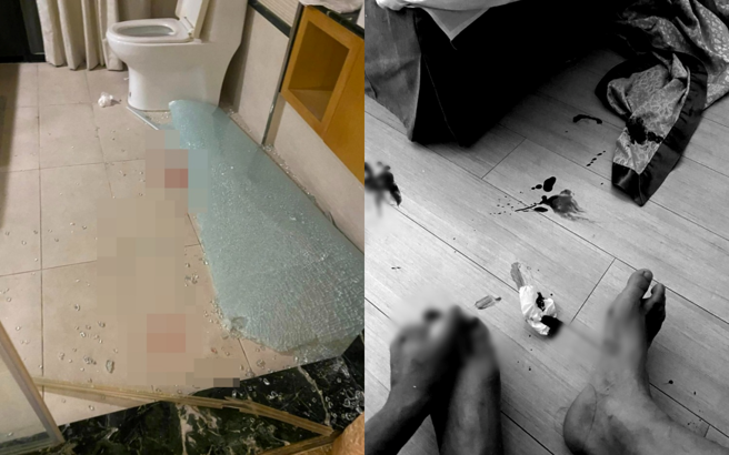 一名網友在臉書分享自己入住宜蘭知名溫泉會館，卻慘遇玻璃門爆裂 ，夫妻兩人遍體鱗傷。(翻攝自臉書爆料公社)