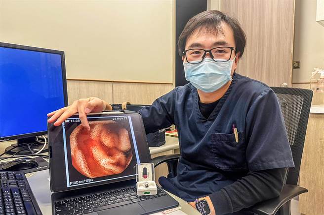 中医大新竹附设医院消化科医师范峻维指安全性高「胶囊内视镜」检查，很容易找出小肠出血位置。（罗浚滨摄）