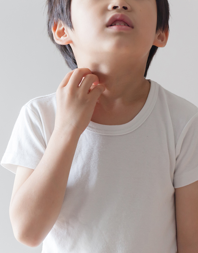 过敏原检测要做吗？ 几岁可以带小孩去做？（图/ 婴儿与母亲提供）