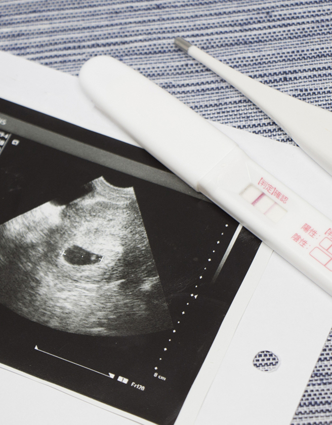 夫妻双方需凝聚共识，同为家庭计画所努力，毕竟怀孕不是太太一个人的事，可手牵手从健康检查生育力评估做起。（图/ 婴儿与母亲提供）