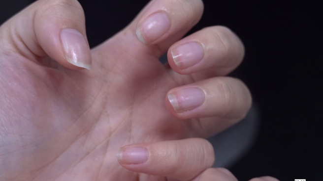 姚医师说不论是中西医，都能从指甲的甲床、甲面上看出一个人的健康问题。(图 / 中时资料库)