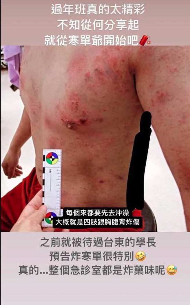 急诊医师黄京苇表示，很多人不知道其实寒单爷就是一般人，炸伤后都来挂急诊。(翻摄自黄京苇IG)