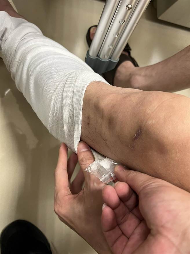 林男進警局才裝石膏的行為引起警方注意，果然發現裡頭藏有毒品。(黃敬文翻攝)
