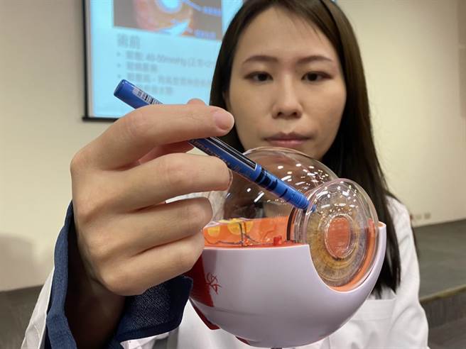 中国医药大学附设医院眼科医学中心医师李宥伶指出，眼球分泌的「房水」阻塞，会造成眼压上升，伤及眼底的视觉神经，透过「青光眼导管植入术」置入导管将角膜与虹膜间房水自引流管排出，可降低眼压，减缓视神经受损。（冯惠宜摄）
