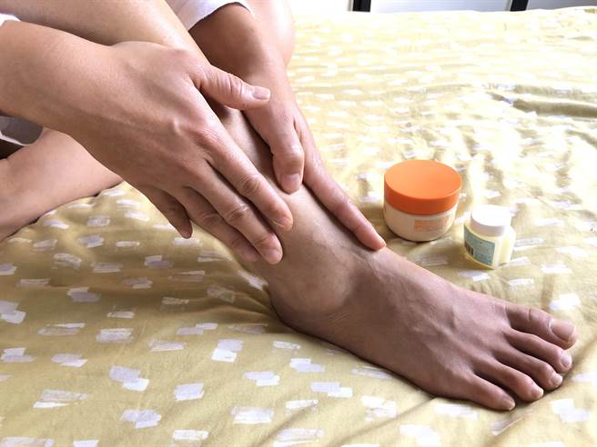 部分民眾皮膚容易過敏，有些皮膚易乾燥的人，更要勤加的保養皮膚，避免「傷痕累累」。(慈濟醫院提供)